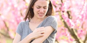 woman scratching itchy arm after insect bite in a field of peach trees in spring time