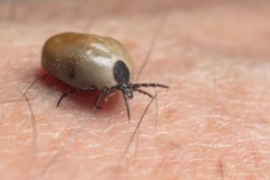 A tick is walking on a human skin